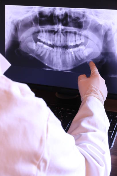 Best Emergency Treatment for Dental Infections or Abscesses in Lynden, WA