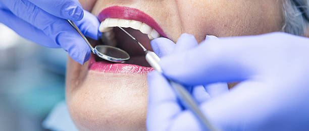 Best Urgent Care for Lost Fillings or Crowns in Lynden, WA